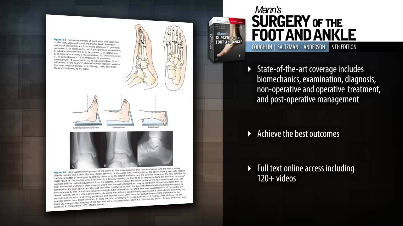 Mann’s Surgery of the Foot and Ankle, 2-Volume Set, 9th Edition