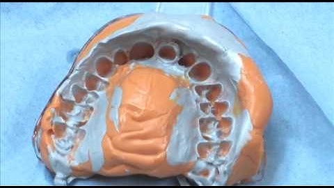 Coltene ParaCore by Dr. Stefan Paul | pinkblue