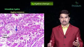 Morphology of Reversible cell injury - General Pathology Animated Lecture -Dr Bhanu prakash