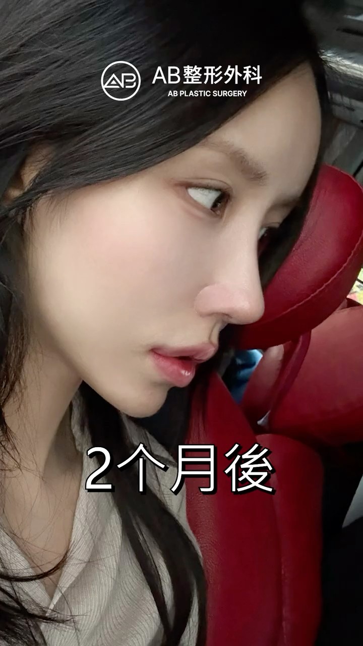第一次隆鼻就變超美｜手術過程全紀錄 #shorts