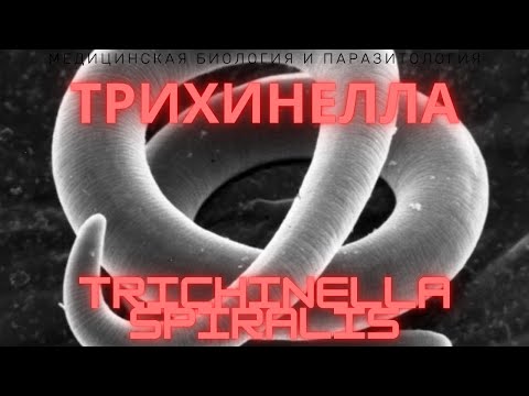 Трихинелла - Trichinella spiralis - Трихинеллез: Жизненный Цикл, Симптомы, Диагностика, Профилактика