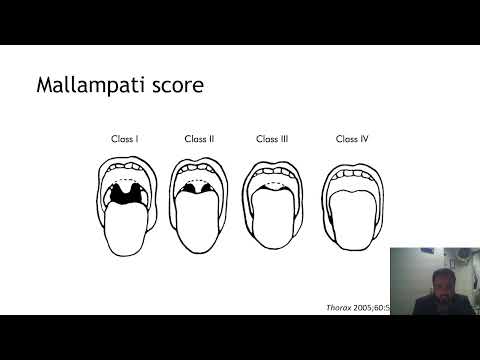  OSA 2 | PSP CON VIDEO 2024 || Mix