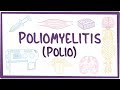 Poliomyelitis - causes, symptoms, diagnosis, treatment, pathology