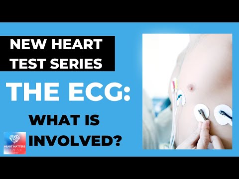 Video: Wat is een ECG-test?