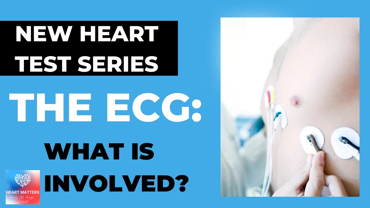 The Electrocardiogram (ECG / EKG) Heart Matters