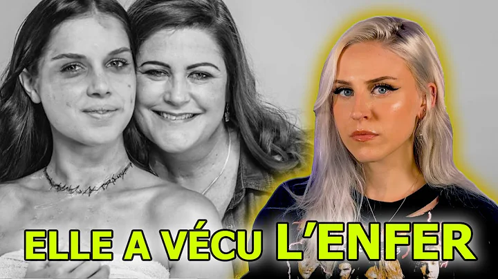Elle a subi les pires tortures mais a survcu - L'a...
