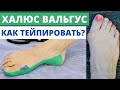 ✅Эффективное тейпирование при халюс вальгус! Косточка на ноге.