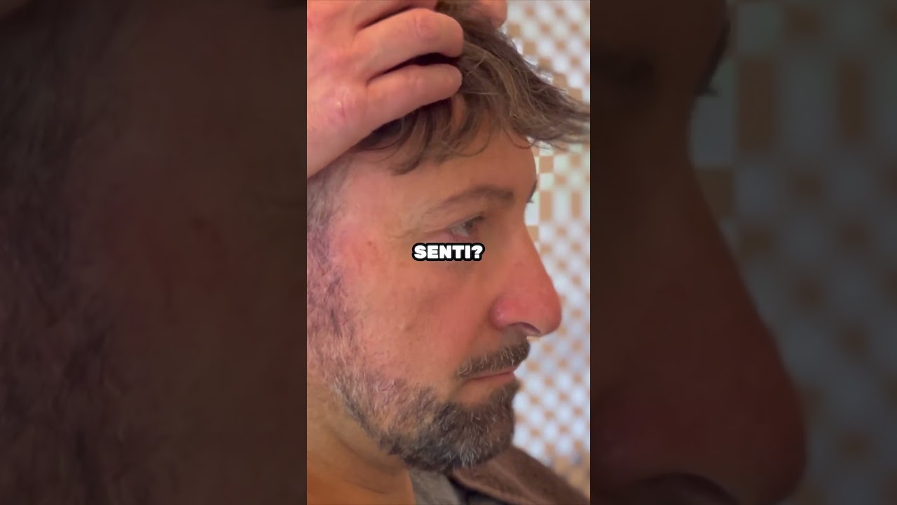 Come mettere una protesi capillare 