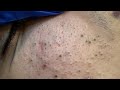 Sofia Korean Skincare Routine (For Clear, Acne-Free Skin)