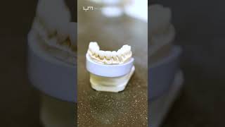 How Dentures are made in 2024  #shorts #dentallab
