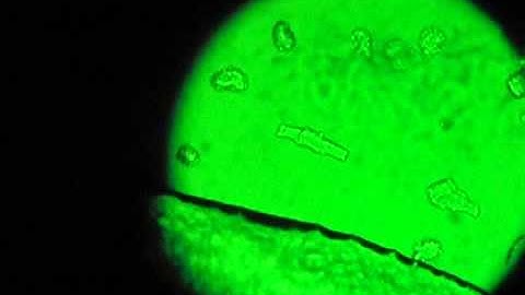 Conductive polymer-based bioelectronic sensor
