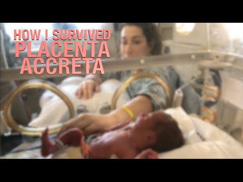 Video: Je Leeft Maar Twee Keer: Multidisciplinair Beheer Van Catastrofale Gevallen In Placenta Accreta Spectrum - Een Casusrapport