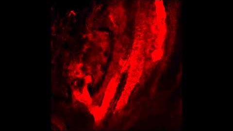 Real-time imaging of flow through the placental vasculature.