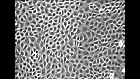Kidney tissue dancing in an electric field