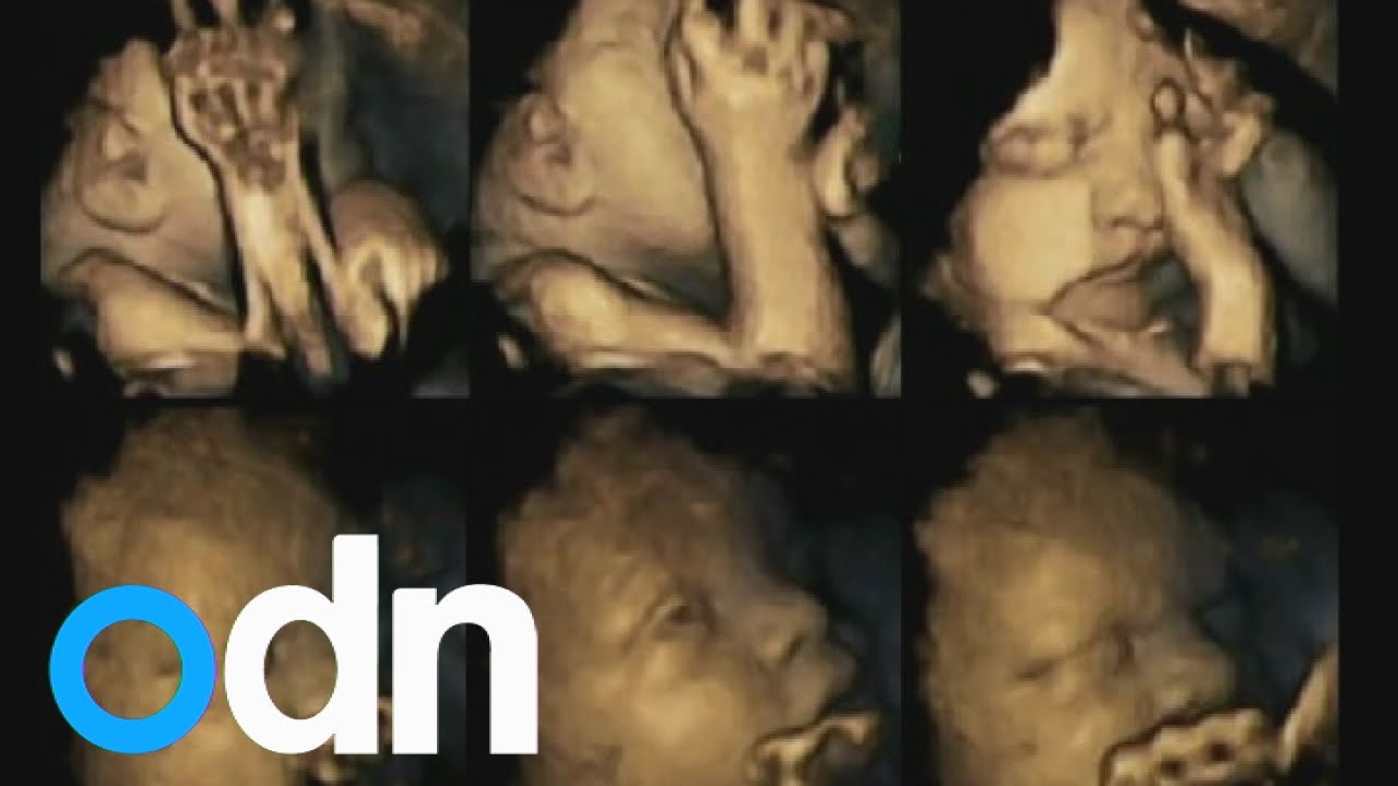 This Is What Smoking Does To An Unborn Baby