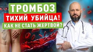 Тромбоз – тихий убийца! Как не стать жертвой?