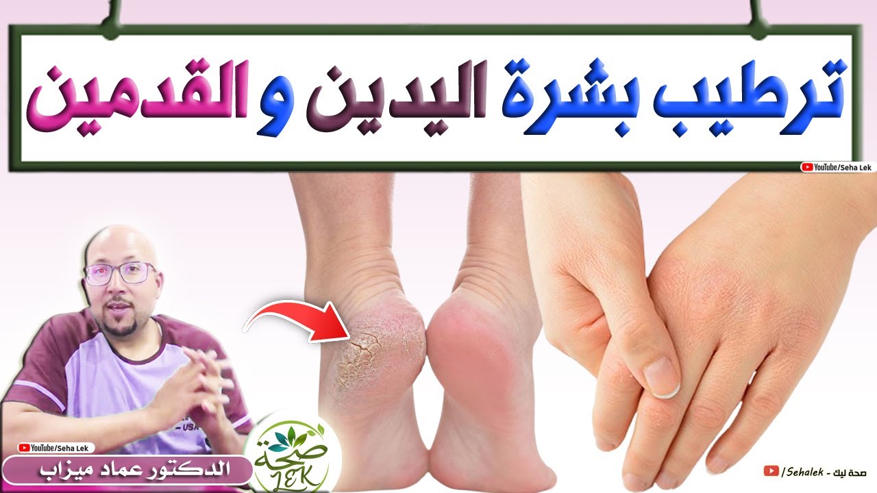 وصفات طبيعية لترطيب بشرة اليدين والقدمين / د. عماد ميزاب Doctor imad mizab