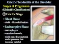 Calcific Tendonitis - Everything You Need To Know - Dr. Nabil Ebraheim