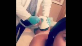 #AmberQuinn #Velashape3