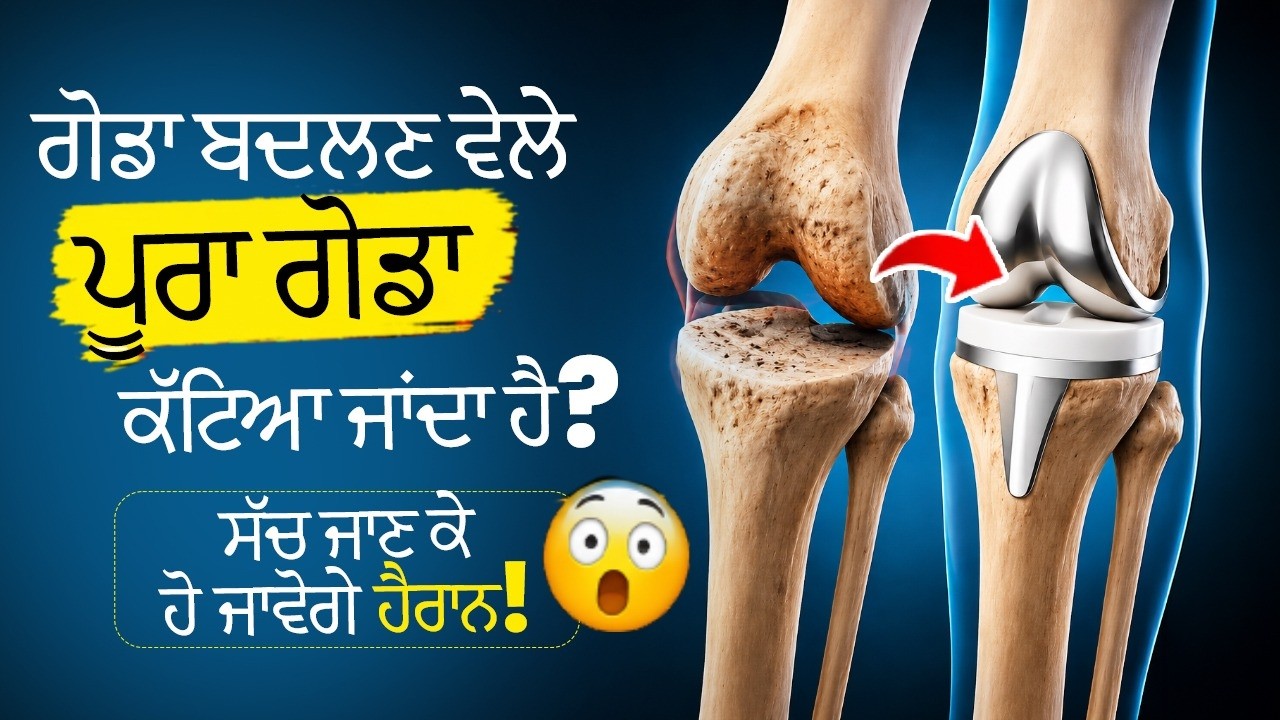 What Really Happens Inside Your Knee During Replacement?Knee Replacement in Ludhian |Kalyan Hospital