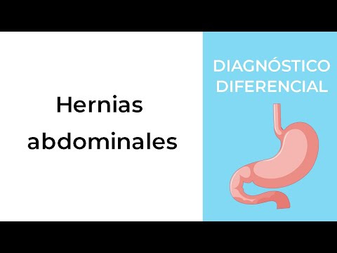 Diagnóstico Diferencial. Hernias abdominales