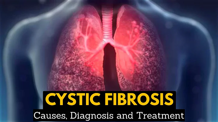 CYSTIC FIBROSIS, Causes, Signs and Symptoms, Diagnosis and Treatment.