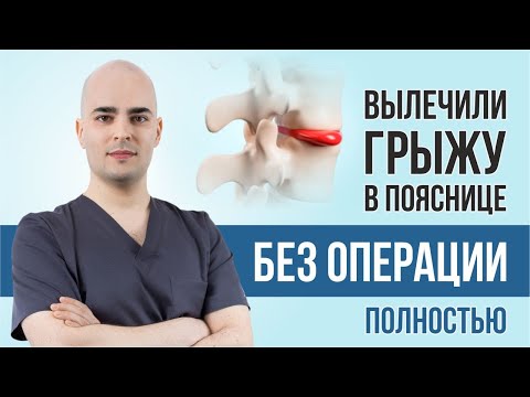 Как Полностью Вылечили Грыжу Позвоночника В Пояснице. Разбор Мрт. Резорбция Грыжи Диска В Пояснице.