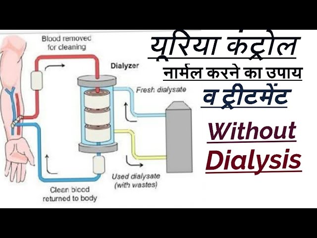 Kidney Test Kaise Kiya Jata Hai - kidneyoi