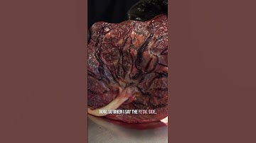 This Is a Real Human Placenta