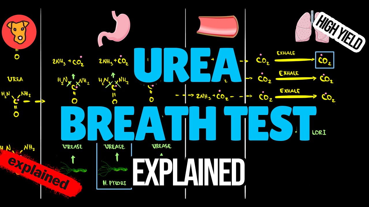 Urea Breath Test EXPLAINED Detecting Helicobacter Pylori Beginner s Urea Breath Test EXPLAINED Detecting Helicobacter Pylori Beginner s