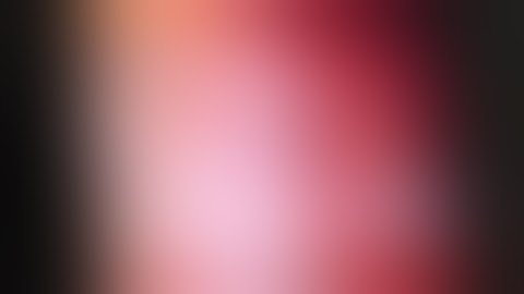 Dr. Ted Brisson - Robotic Partial Nephrectomy