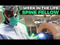 Week in the Life of a Spine Fellow