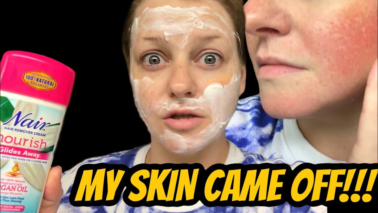 i-naired-my-face-chemical-burns-youtube
