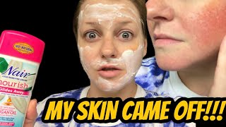 I Naired my Face Chemical Burns