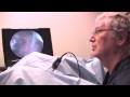 Ablation with Houston ObGyn Dr. Maurice Leibman