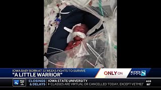 Waukee 'micropreemie' born at just 22 weeks in NICU at Iowa hospital