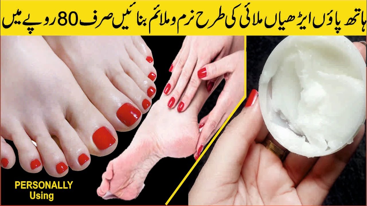 Remove Cracked Heels Remedy Get Beautiful Hand Feet Permanently In 2