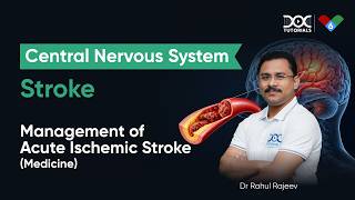 Acute Ischemic Stroke Management: Emergency Approach | CNS | Dr Rahul Rajeev
