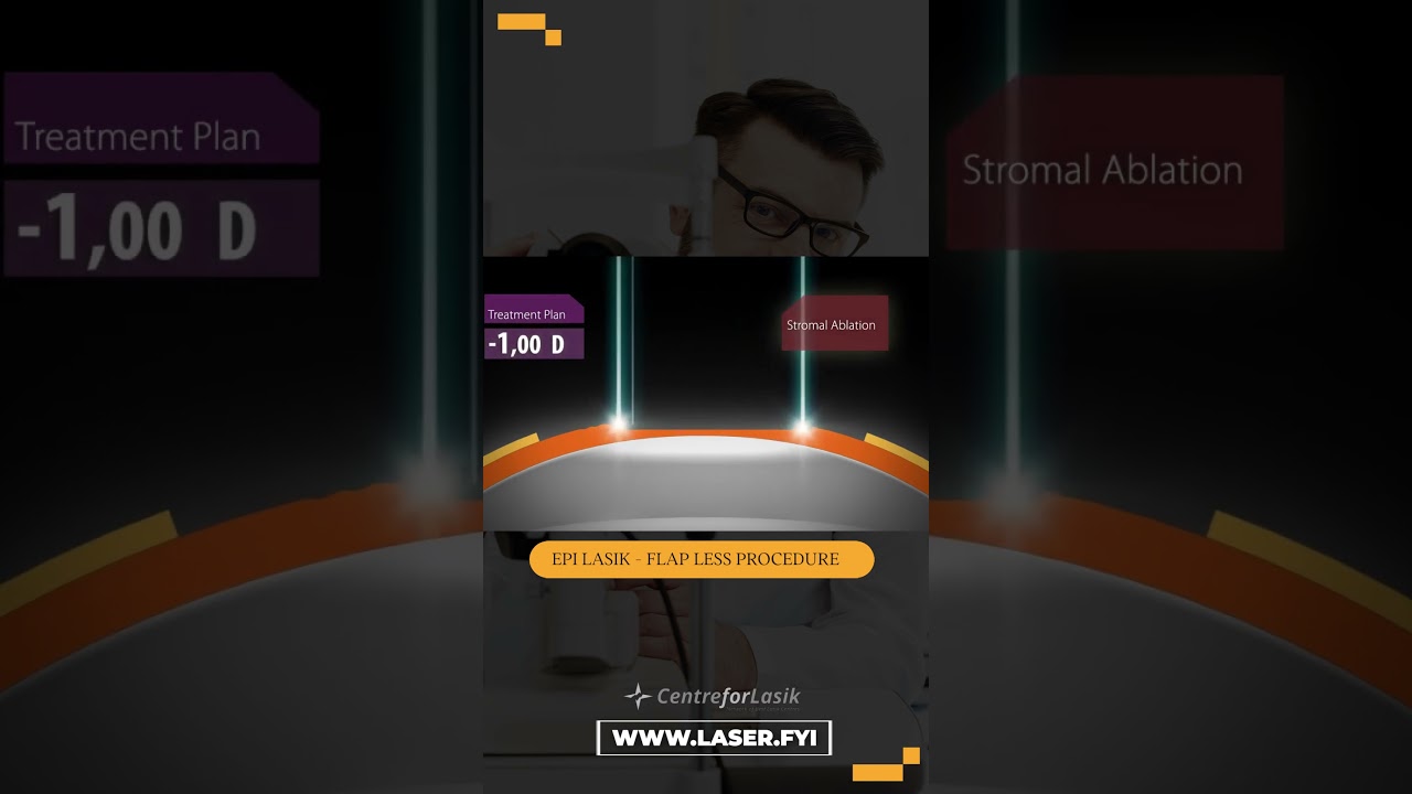 Lasik और EPI Lasik 