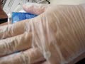 Laser Tattoo Removal