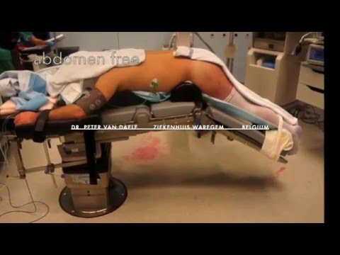 Minimally Invasive Microdiscectomy L5-S1. 