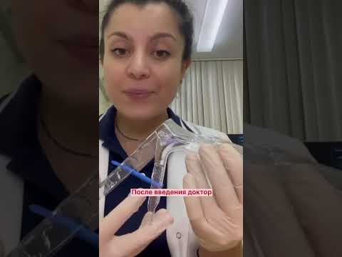Осмотр врачом гинекологом.