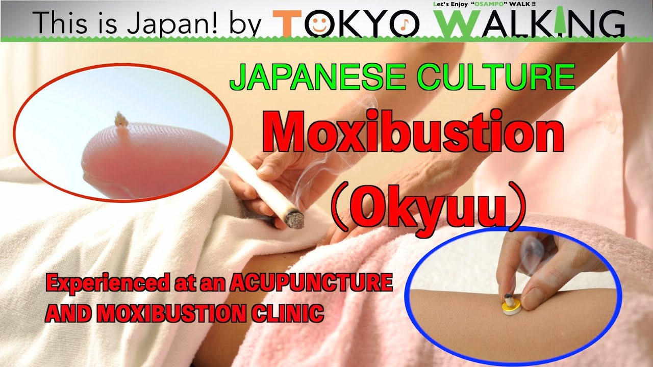 [This is Japan!] Okyuu at an ACUPUNCTURE AND MOXIBUSTION CLINIC - YouTube