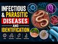 infectious diseases