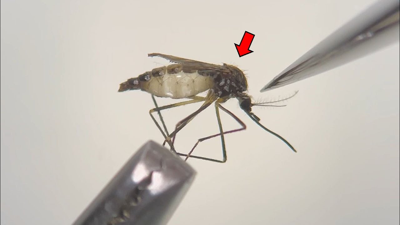 蚊を解剖したら中身が凄すぎた【蚊の解剖】