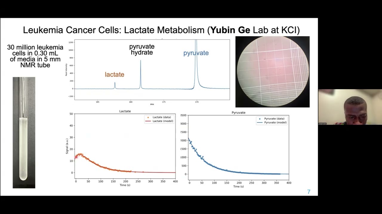Real-Time Metabolic Profiling of Hyperpolarized Pyruvate-to-Lactate Conversion in Leukemia Cells...