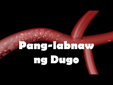 Video: 3 Mga Paraan upang Mag-ehersisyo upang maiwasan ang Mga Dugo ng Dugo