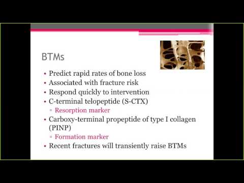 What 2 Osteoporosis Treatment