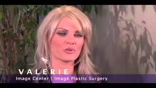 Dr. Peter Newen- Valerie's Mommy Makeover Experience