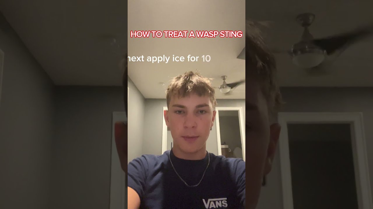 How To Treat A Wasp Sting Emergency